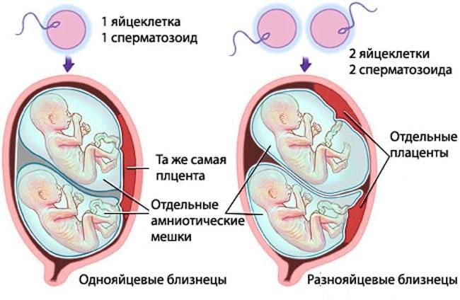УЗИ при многоплодной беременности